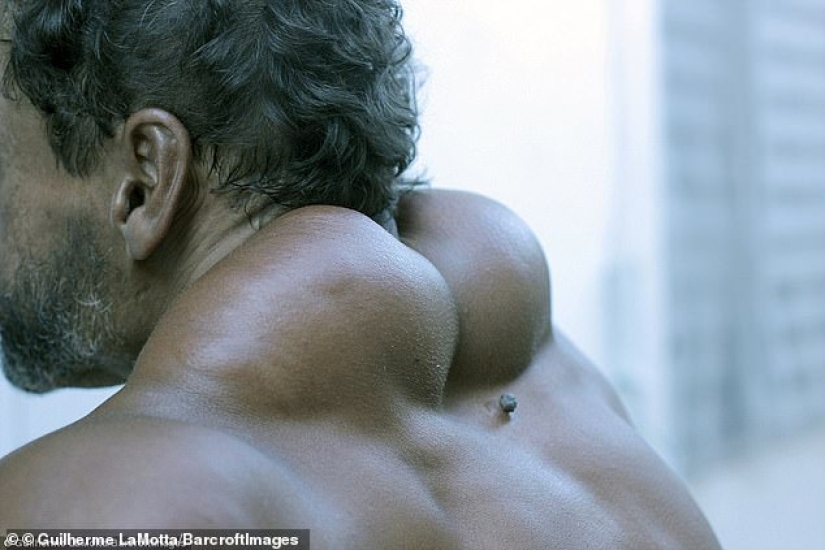 Bulbosaurus from Brazil: former drug addict gives himself oil injections