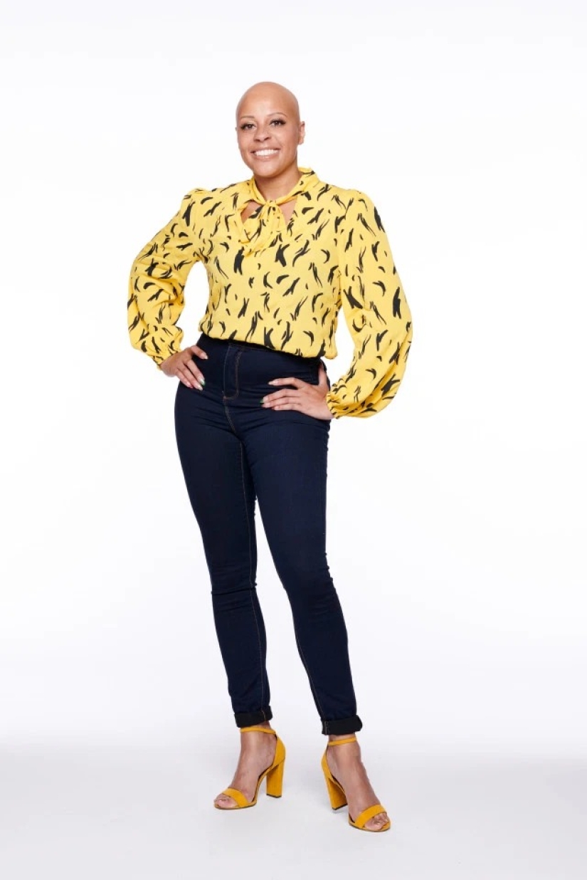 Calvas, valientes, orgullosas: mujeres que aprendieron a vivir con alopecia y se enamoraron de sí mismas sin pelo Calvas, valientes, orgullosas: mujeres que aprendieron a vivir con alopecia y se enamoraron de sí mismas sin pelo