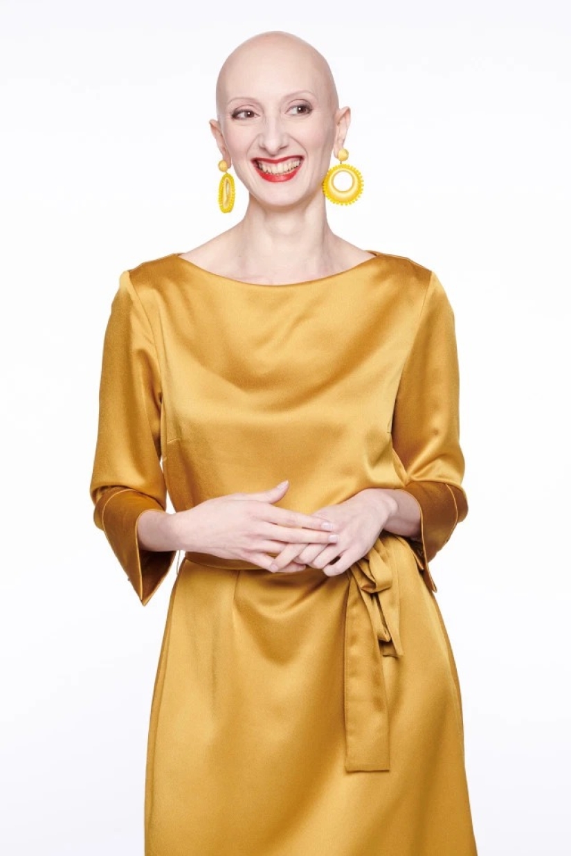 Calvas, valientes, orgullosas: mujeres que aprendieron a vivir con alopecia y se enamoraron de sí mismas sin pelo Calvas, valientes, orgullosas: mujeres que aprendieron a vivir con alopecia y se enamoraron de sí mismas sin pelo