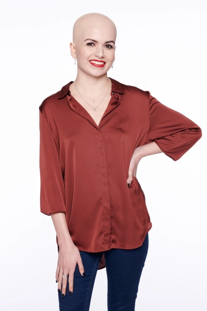 Calvas, valientes, orgullosas: mujeres que aprendieron a vivir con alopecia y se enamoraron de sí mismas sin pelo Calvas, valientes, orgullosas: mujeres que aprendieron a vivir con alopecia y se enamoraron de sí mismas sin pelo