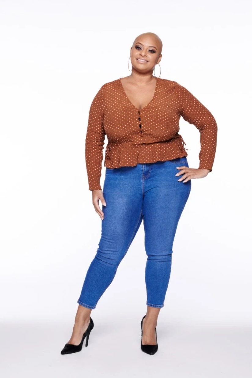 Calvas, valientes, orgullosas: mujeres que aprendieron a vivir con alopecia y se enamoraron de sí mismas sin pelo Calvas, valientes, orgullosas: mujeres que aprendieron a vivir con alopecia y se enamoraron de sí mismas sin pelo