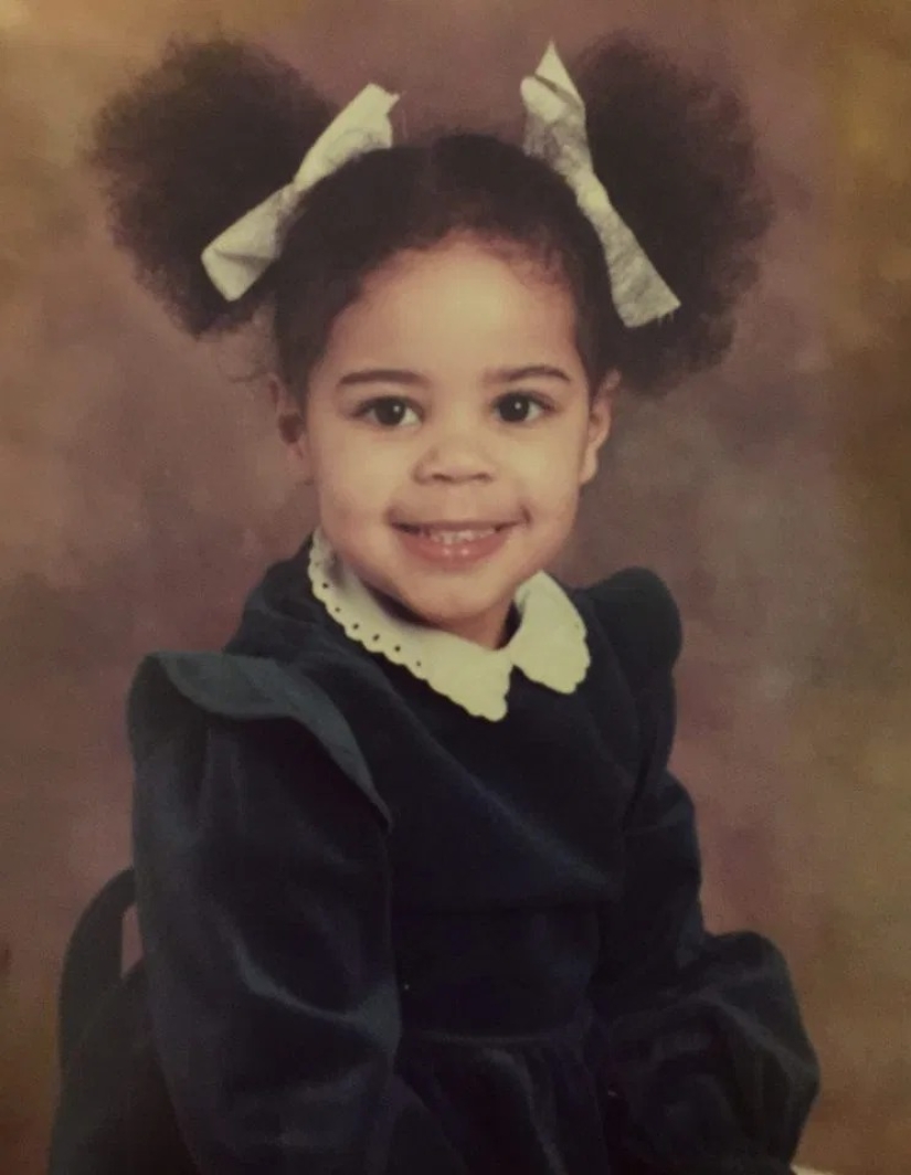 Calvas, valientes, orgullosas: mujeres que aprendieron a vivir con alopecia y se enamoraron de sí mismas sin pelo Calvas, valientes, orgullosas: mujeres que aprendieron a vivir con alopecia y se enamoraron de sí mismas sin pelo