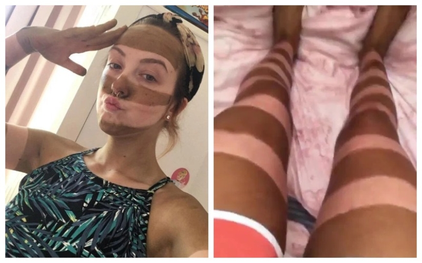 Cebra en cuarentena: una mujer hizo un bronceado a rayas y lo considera una idea brillante Cebra en cuarentena: una mujer hizo un bronceado a rayas y lo considera una idea brillante