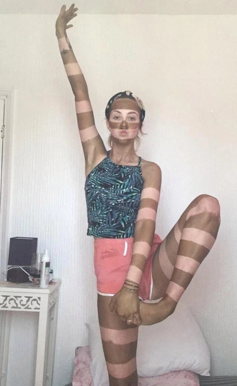 Cebra en cuarentena: una mujer hizo un bronceado a rayas y lo considera una idea brillante Cebra en cuarentena: una mujer hizo un bronceado a rayas y lo considera una idea brillante