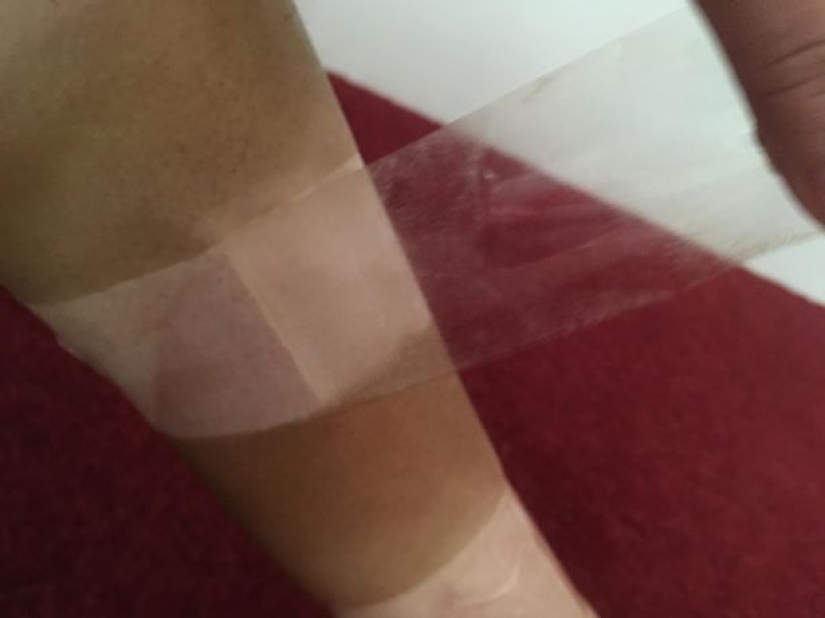 Cebra en cuarentena: una mujer hizo un bronceado a rayas y lo considera una idea brillante Cebra en cuarentena: una mujer hizo un bronceado a rayas y lo considera una idea brillante
