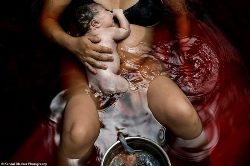 Celebración de la vida: las primeras lágrimas, alegría, llanto y dolor en las fotos del concurso anual "El nacimiento se convierte en ella"