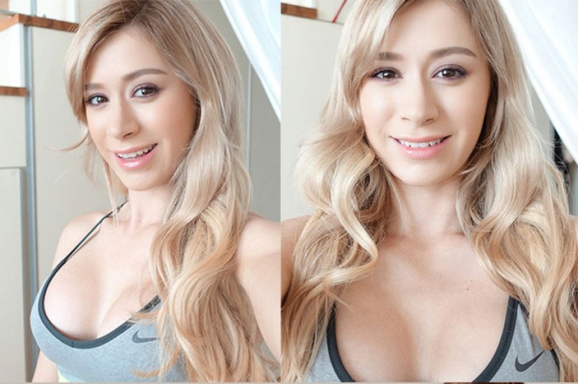 "Cinderella plastic surgery": Japanese practice breast augmentation for a day