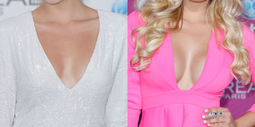 "Cinderella plastic surgery": Japanese practice breast augmentation for a day