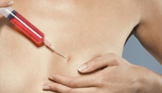 "Cinderella plastic surgery": Japanese practice breast augmentation for a day