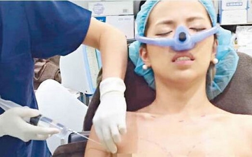 "Cinderella plastic surgery": Japanese practice breast augmentation for a day