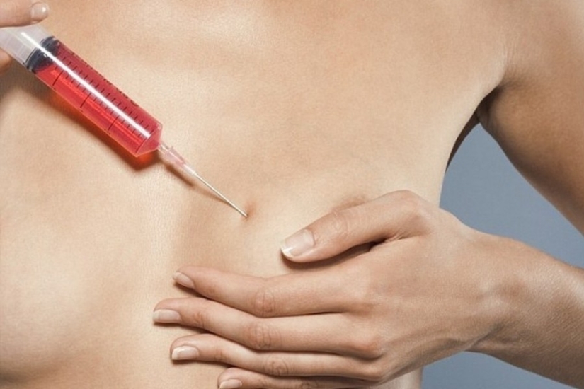 "Cirugía plástica de cenicienta": las japonesas practican el aumento de senos por un día