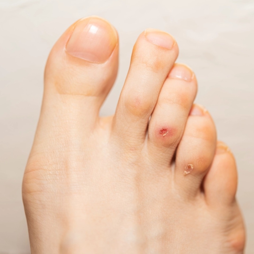 Cómo los pies muestran el estado de salud: 8 señales sobre enfermedades graves Cómo los pies muestran el estado de salud: 8 señales sobre enfermedades graves