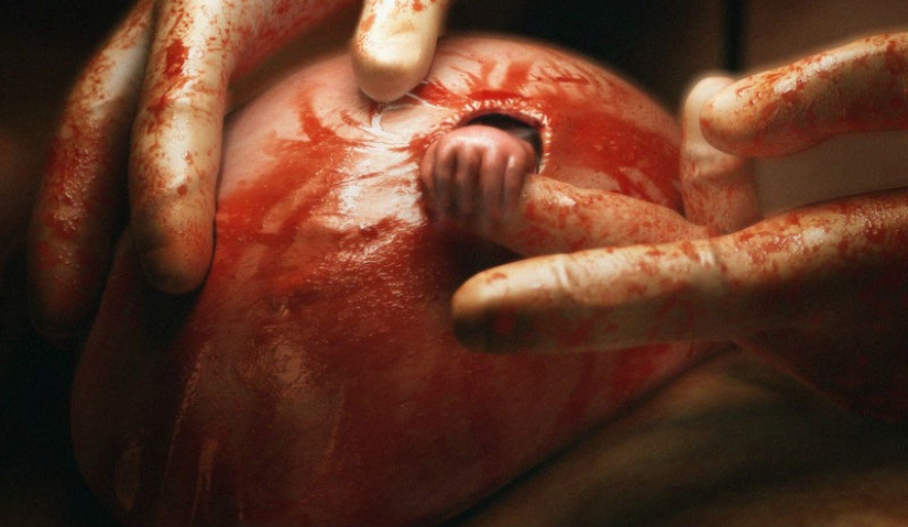 Cómo se ve hoy el niño de la famosa foto "La mano de la esperanza"