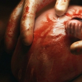 Cómo se ve hoy el niño de la famosa foto "La mano de la esperanza"