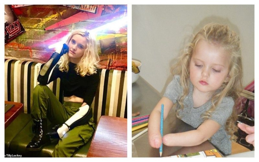 Cómo una niña de 13 años con prótesis biónicas en lugar de manos se convirtió en maquilladora profesional