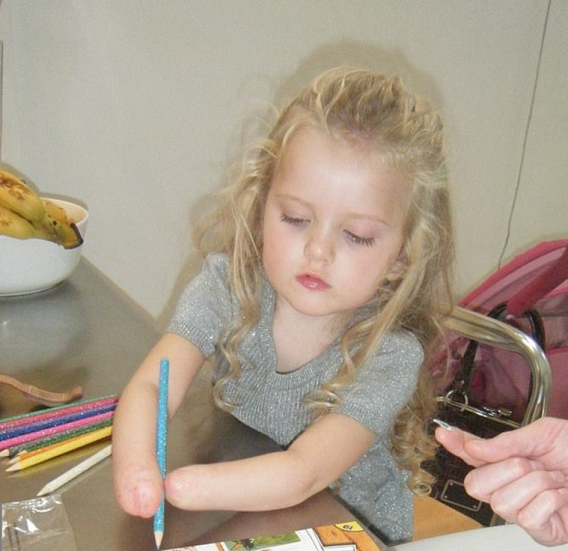 Cómo una niña de 13 años con prótesis biónicas en lugar de manos se convirtió en maquilladora profesional