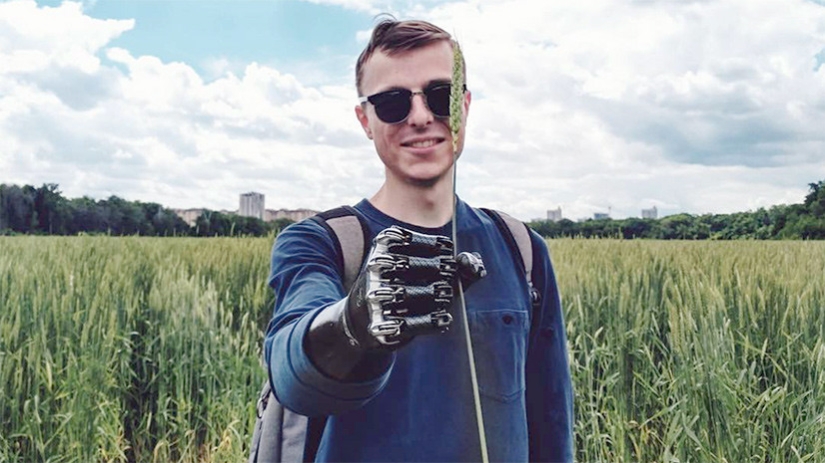 Cómo vive Cyborg Kostya: revelaciones de un tipo sin manos