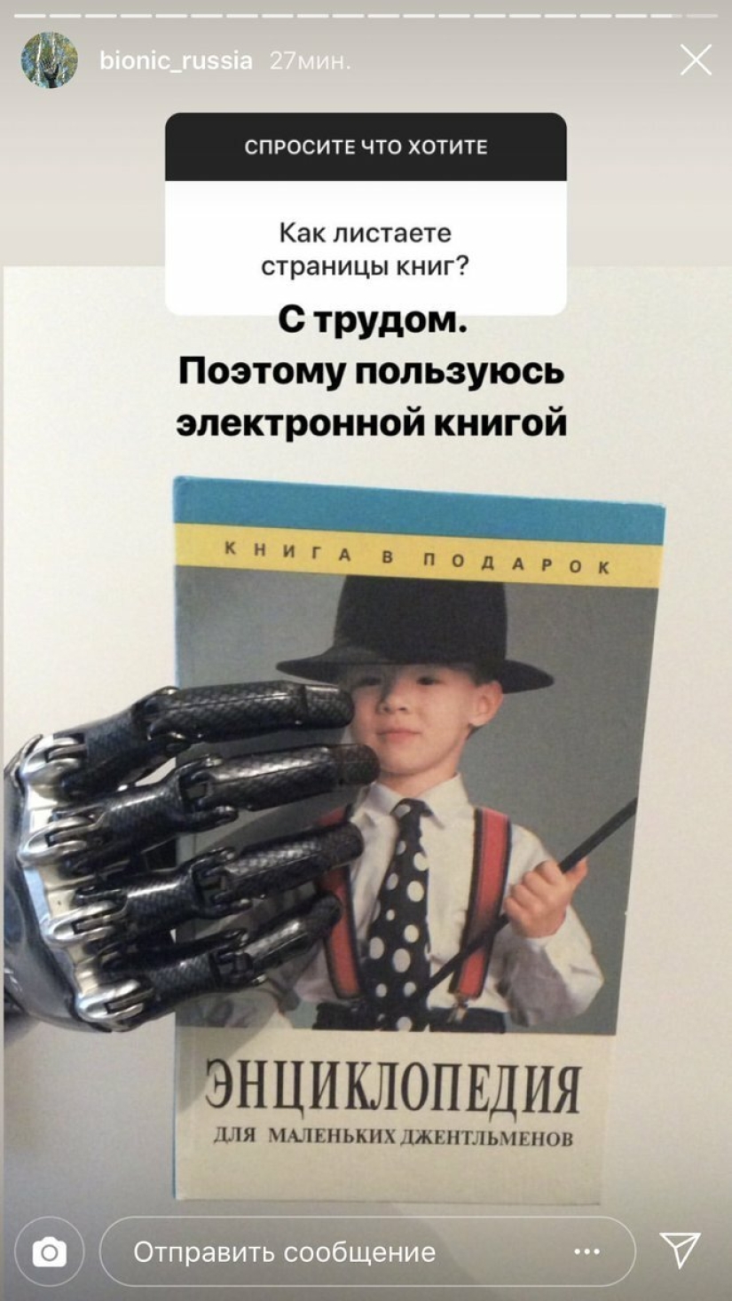 Cómo vive Cyborg Kostya: revelaciones de un tipo sin manos