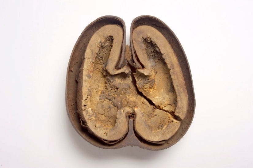 Coco de mer: a piquant palm that makes you blush