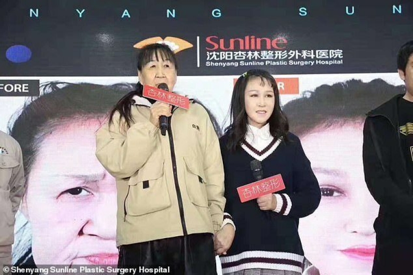 De abuela a niña: una mujer china de 15 años con rostro de anciana se sometió a una cirugía