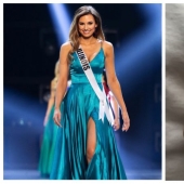 Deadly manicure: the beauty queen was diagnosed with cancer after nail extensions