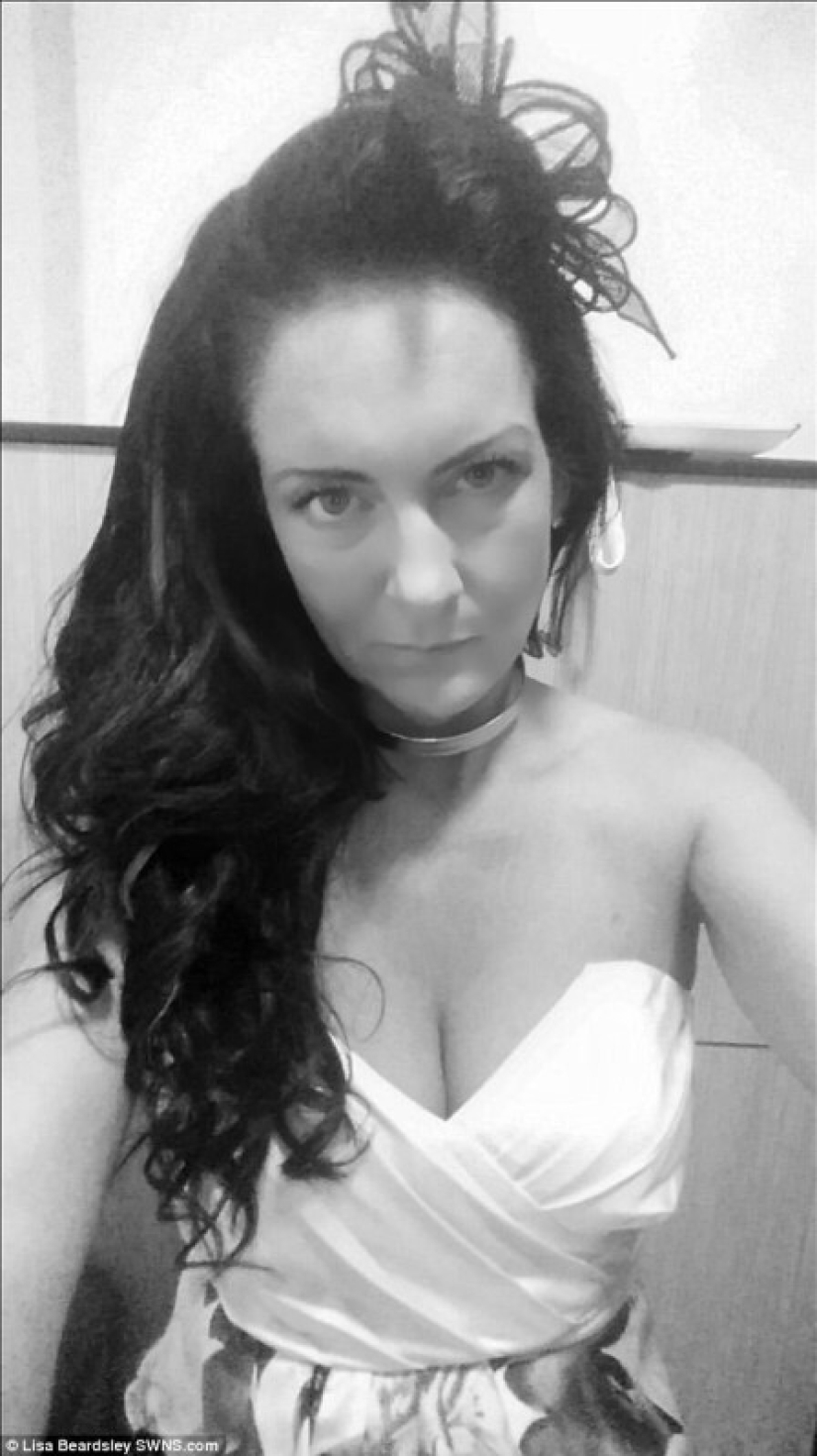 Debido al herpes zóster, la mujer británica ahora tiene la cara de una "perra gruñona"