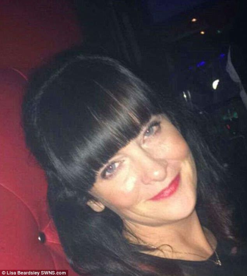 Debido al herpes zóster, la mujer británica ahora tiene la cara de una "perra gruñona"