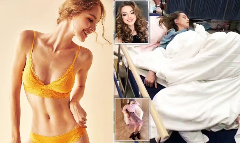 Desfile de moda mortal: modelo rusa casi muere de meningitis en China Desfile de moda mortal: modelo rusa casi muere de meningitis en China