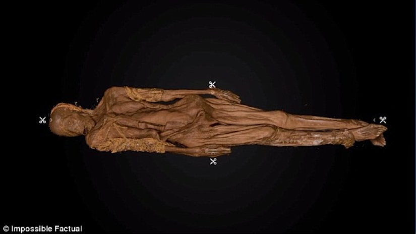 Died of smallpox in 1851: the identity of the girl buried in an iron coffin in New York is established