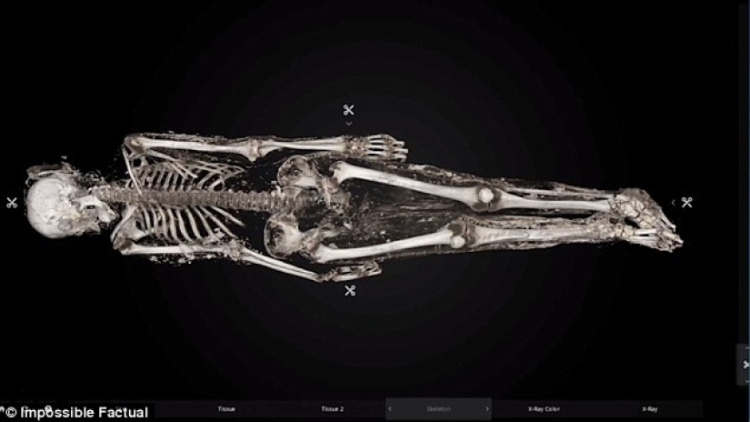 Died of smallpox in 1851: the identity of the girl buried in an iron coffin in New York is established