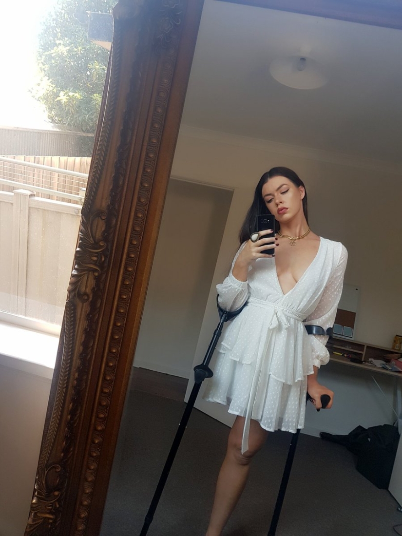 Disabled people can also be beautiful and stylish: how a Mexican wheelchair user inspires others