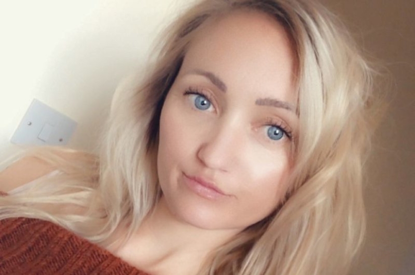 Efecto Benjamin Button: mujer británica de 31 años "envejece al revés" y se ve más joven que a los 15