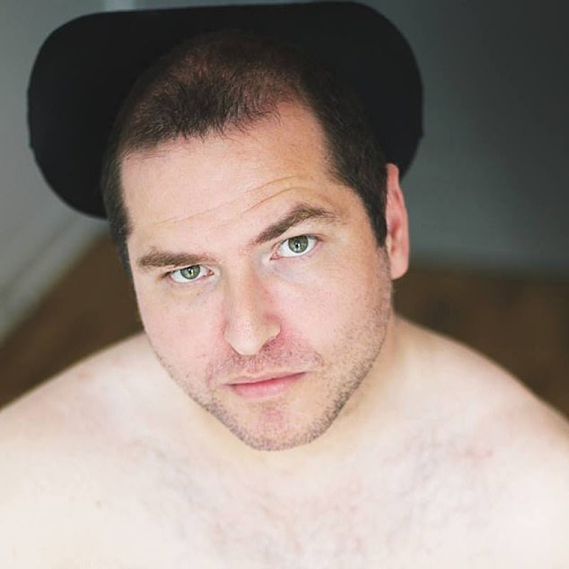 El derecho a la belleza: las personas con discapacidad comparten fotos atractivas en las redes sociales