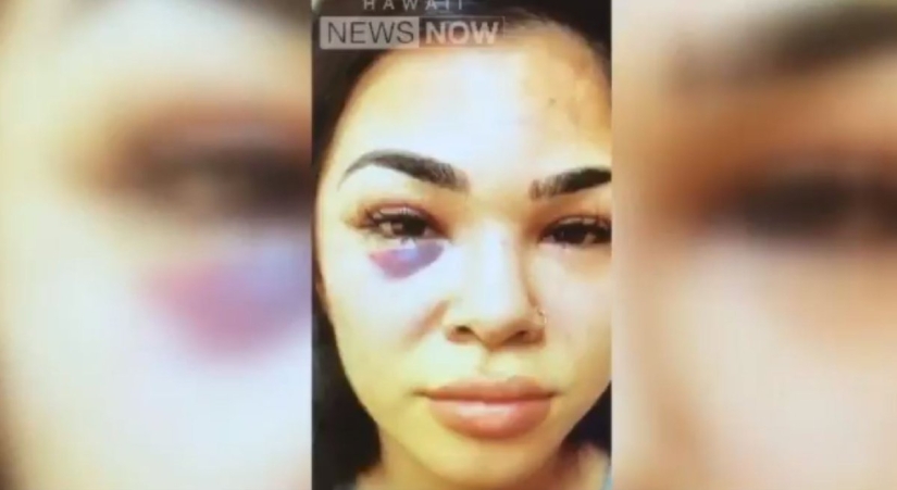 El estadounidense golpeó a su esposa, pero el tribunal tuvo en cuenta su profesión y dictó una sentencia indulgente