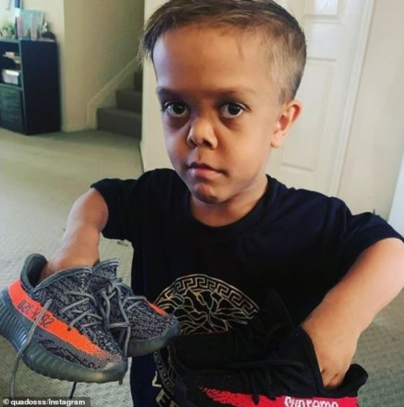 El gran corazón de un hombrecito: un comediante estadounidense recaudó 2 200,000 para ayudar a un niño enano El gran corazón de un hombrecito: un comediante estadounidense recaudó 2 200,000 para ayudar a un niño enano