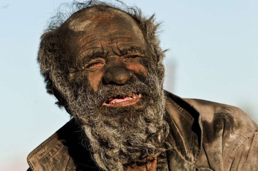 El hombre más sucio del mundo murió poco después de bañarse