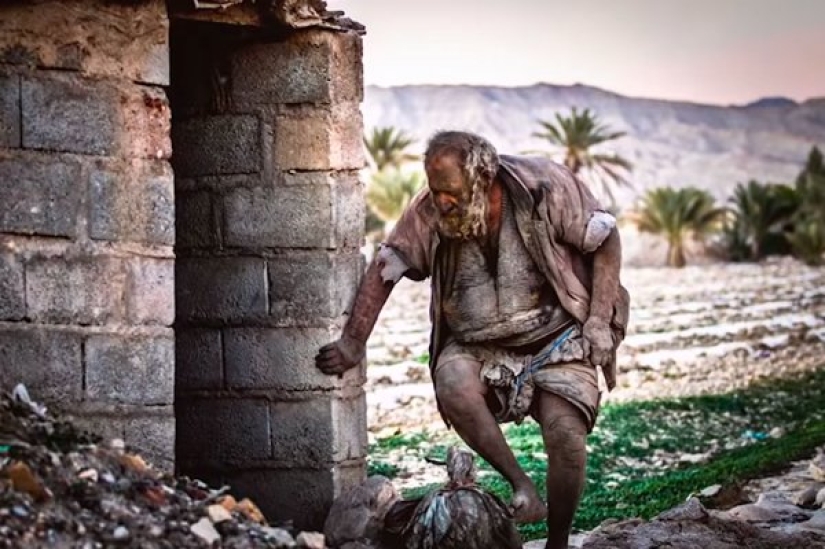 El hombre más sucio del mundo murió poco después de bañarse