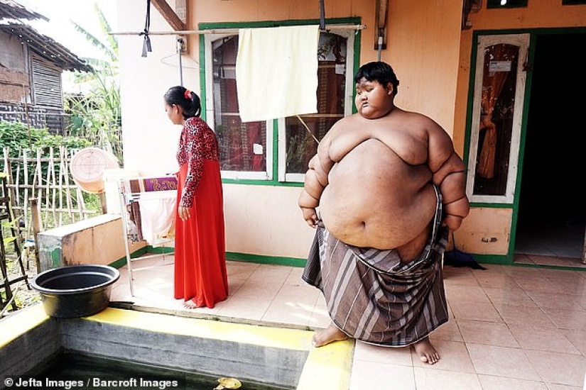 El niño más gordo del mundo, que pesaba 192 kg a la edad de 10 años, perdió más del doble de peso