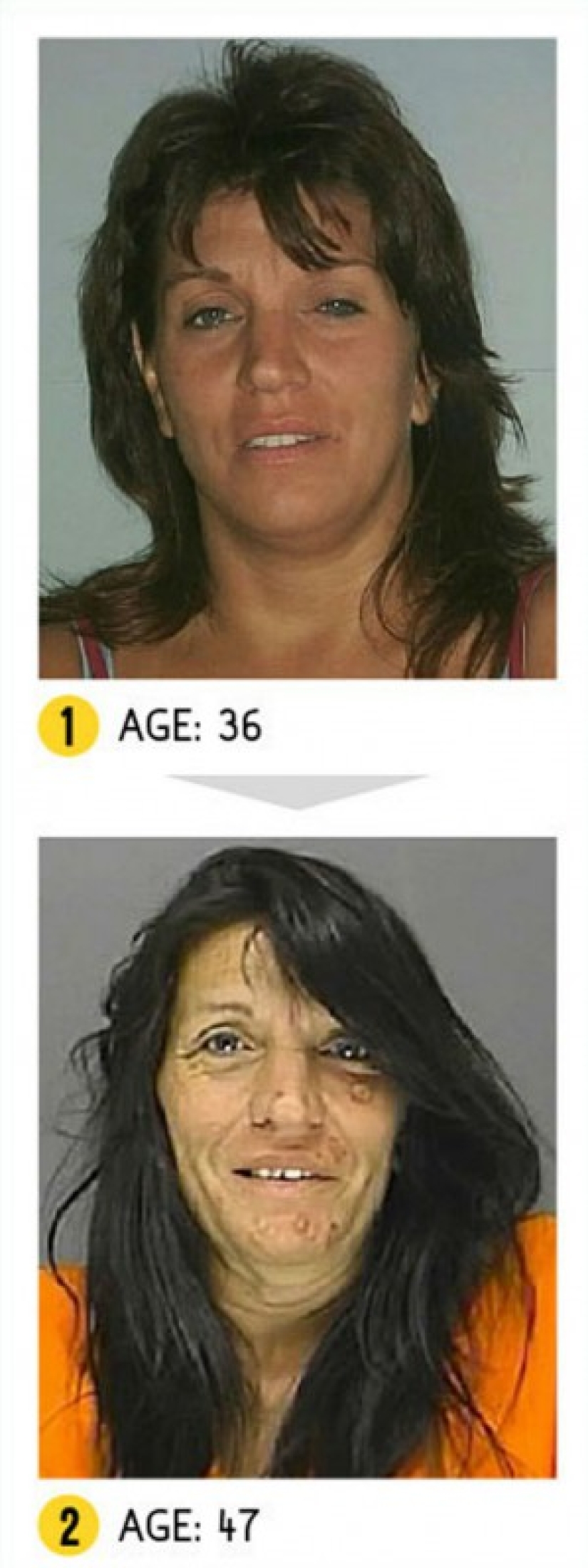 El resultado es obvio: cómo cambia la apariencia de una persona debido a las drogas El resultado es obvio: cómo cambia la apariencia de una persona debido a las drogas