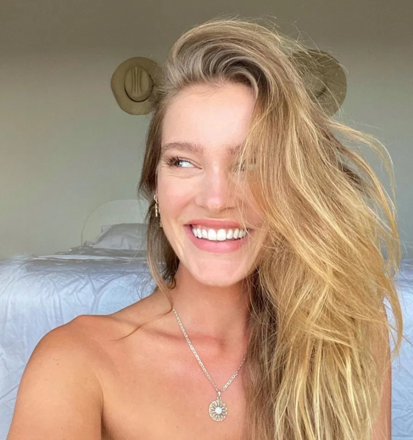 El resultado es obvio: el modelo Sports Illustrated se deshizo del acné, gracias a la nutrición y la meditación