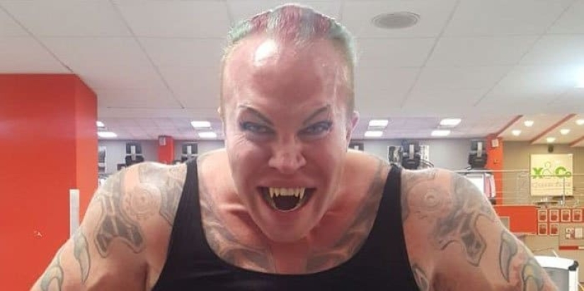 Está de moda? Te doy un diente! Cómo la moda indignante se deslizó en la odontología