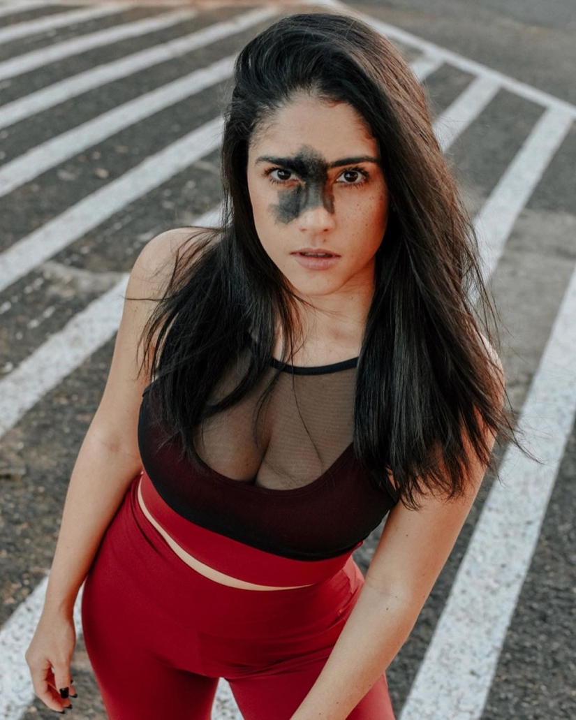 Everyone mocked this girl because of her birthmark, and she took and became a model Everyone mocked this girl because of her birthmark, and she took and became a model