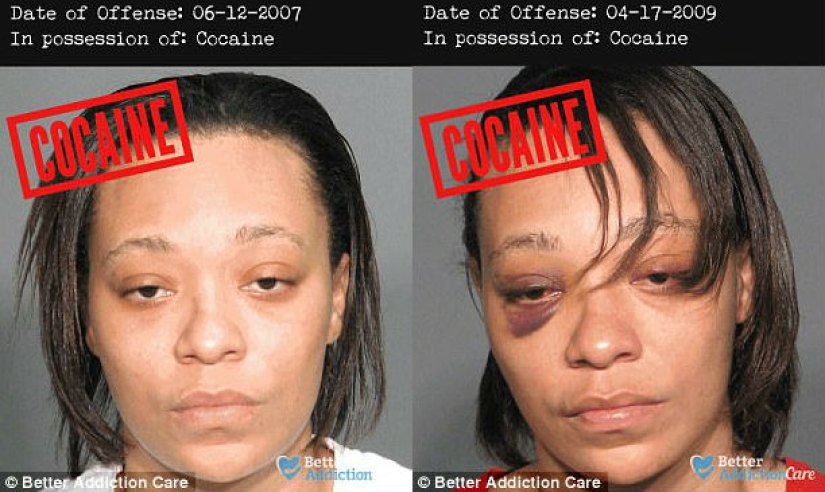 Faces of drug addicts before and after: how do banned substances affect appearance