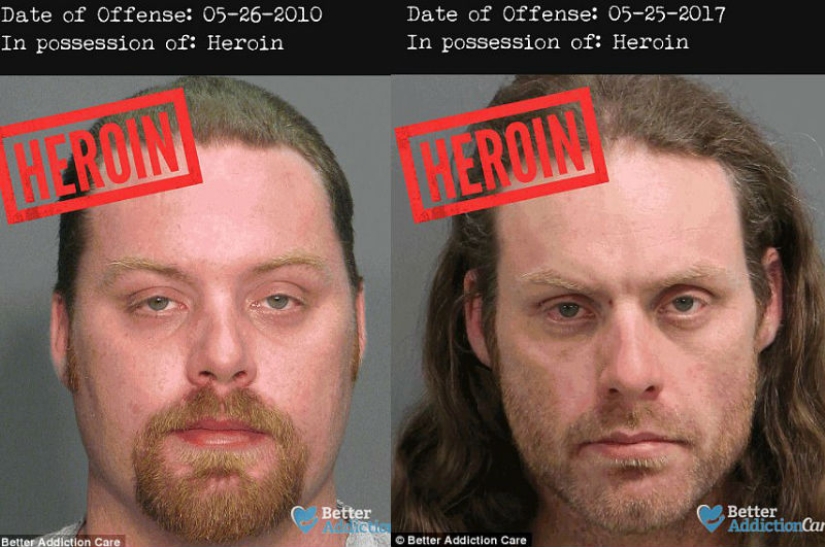 Faces of drug addicts before and after: how do banned substances affect appearance