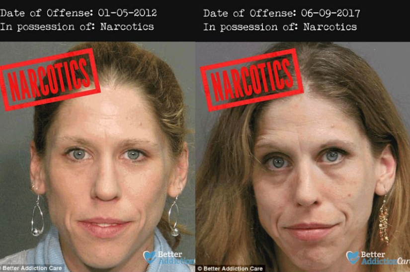 Faces of drug addicts before and after: how do banned substances affect appearance