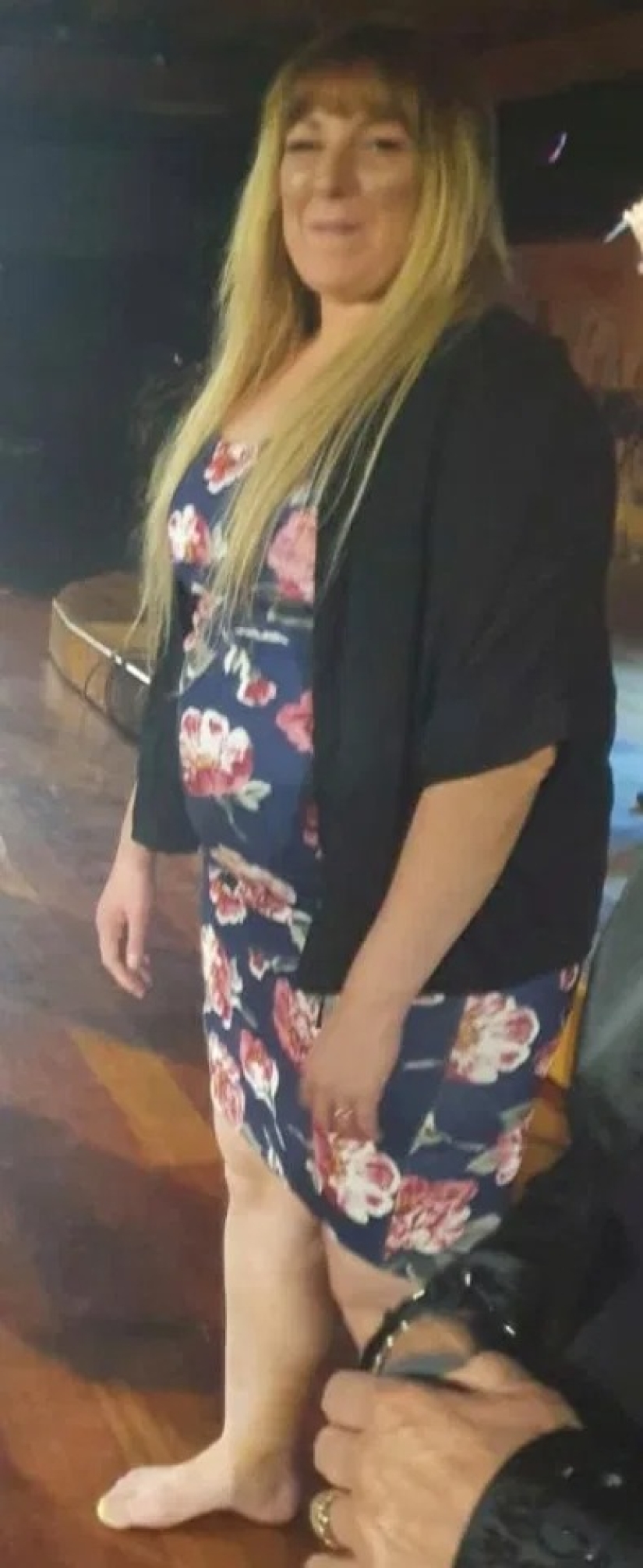 Fear is the best motivator: three women lost weight due to fear of falling into the Covid-19 risk group