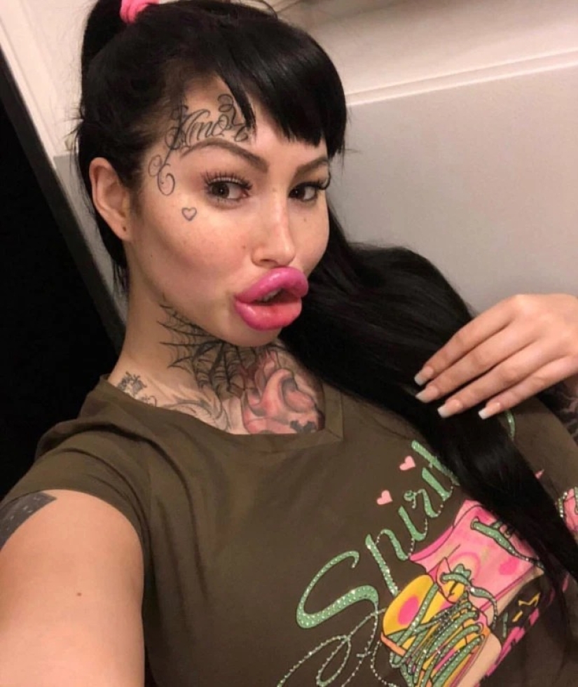 Fetish model almost died during plastic surgery on her vagina
