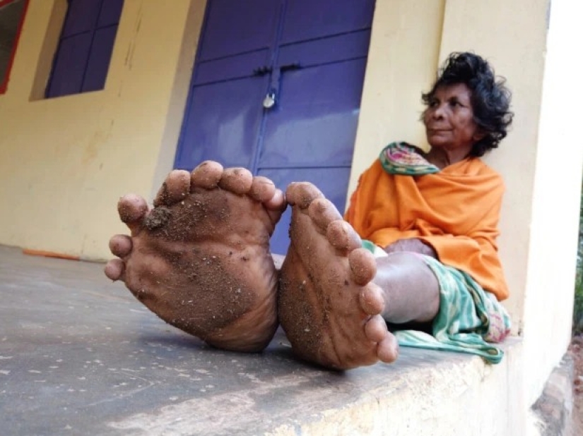 Fingers with a fan: a woman with 31 fingers got into the Guinness Book of Records Fingers with a fan: a woman with 31 fingers got into the Guinness Book of Records