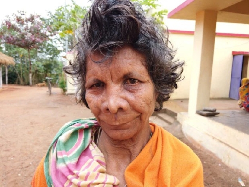 Fingers with a fan: a woman with 31 fingers got into the Guinness Book of Records Fingers with a fan: a woman with 31 fingers got into the Guinness Book of Records