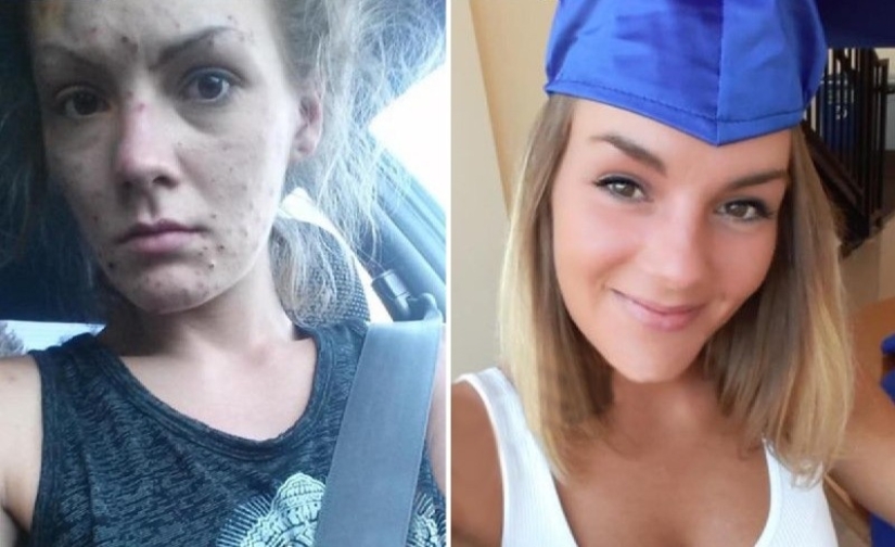 From addiction to freedom: the amazing transformation of a former drug addict From addiction to freedom: the amazing transformation of a former drug addict